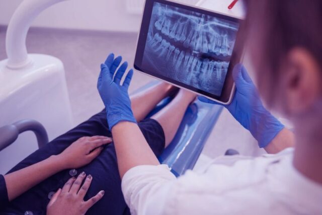 Dental Implants: The New Normal